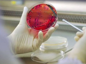 Antibiorésistance : pourquoi les plans des pays ne suffisent toujours pas Antibiorésistance : pourquoi les plans des pays ne suffisent toujours pas