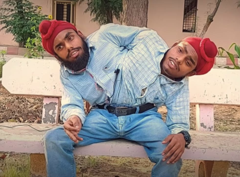 Deux frères siamois décrochent leur job de rêve en Inde