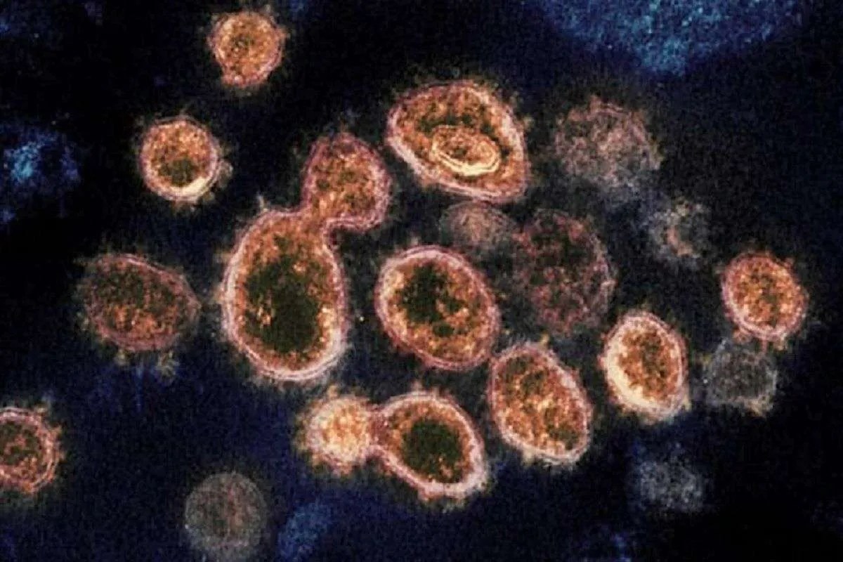 Un nouveau virus zoonotique détecté en Chine