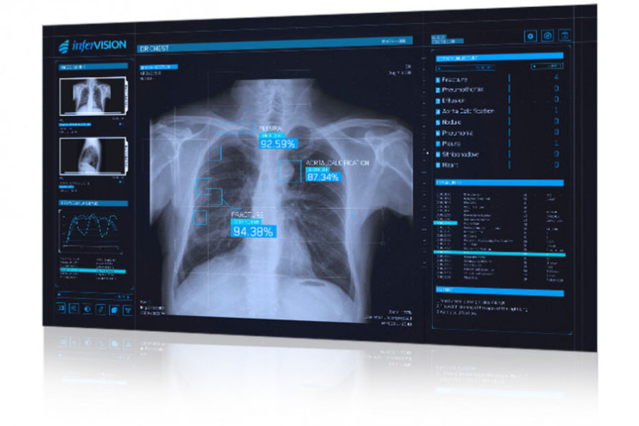 L'imagerie médicale à l’ère du numérique et du post Covid-19