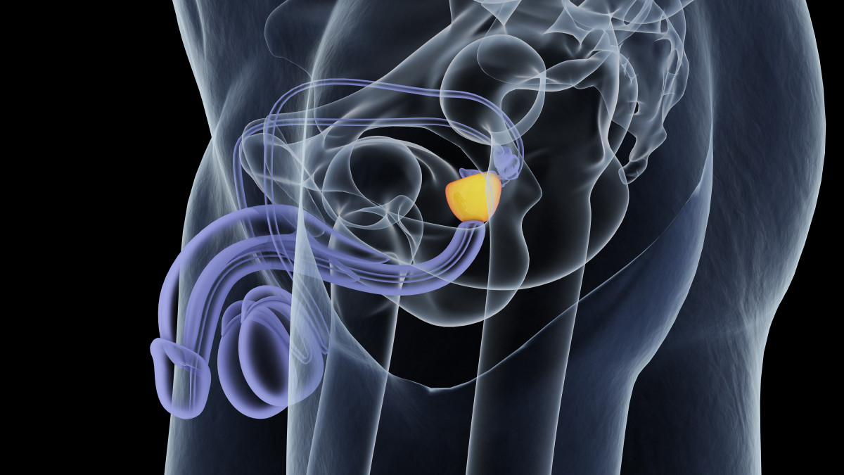 Problémes de prostate ! 10 questions à votre médecin