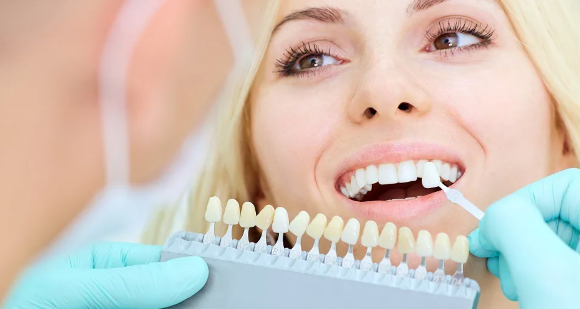 Prothèses dentaires : voici tout ce qu'il faut savoir