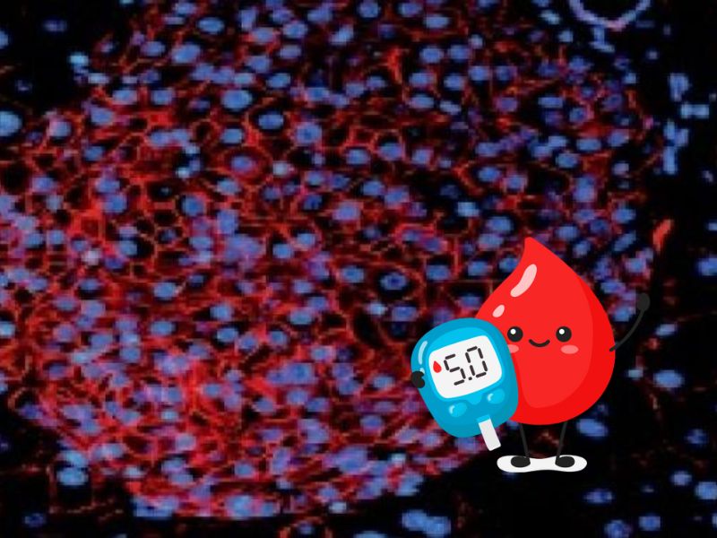 Deux médicaments régénèrent les cellules pancréatiques en seulement 48 heures pour les Diabètiques de type 1