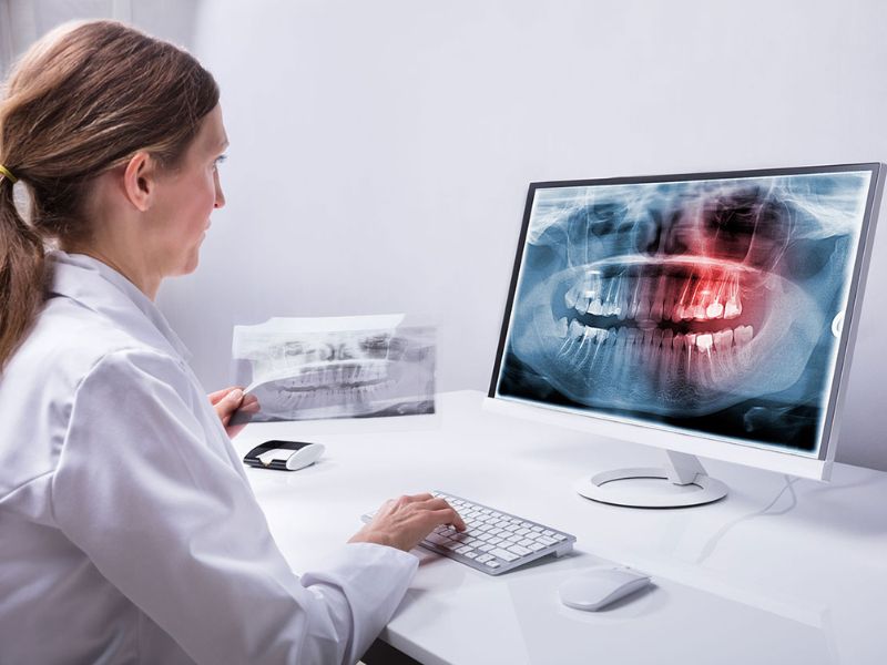 La télédentisterie : Révolutionner l'accès aux soins dentaires au Maroc