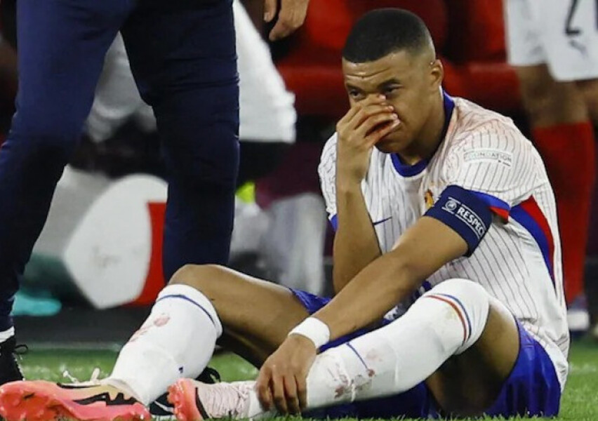 Euro-2024 : Kylian Mbappé incertain pour le match France-Pays-Bas