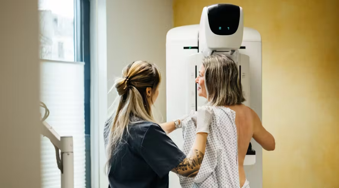 À quelle vitesse évolue un cancer du sein ?