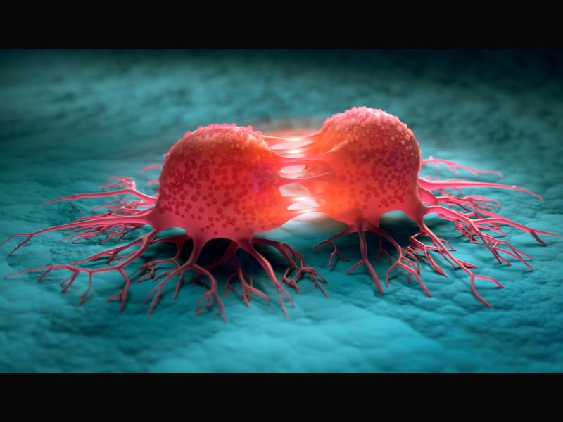 Cancers du foie, du poumon et myélome: des avancées marquantes selon l’ACS