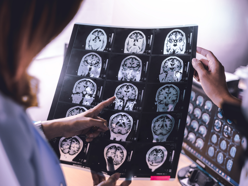 Stimuler l’hippocampe