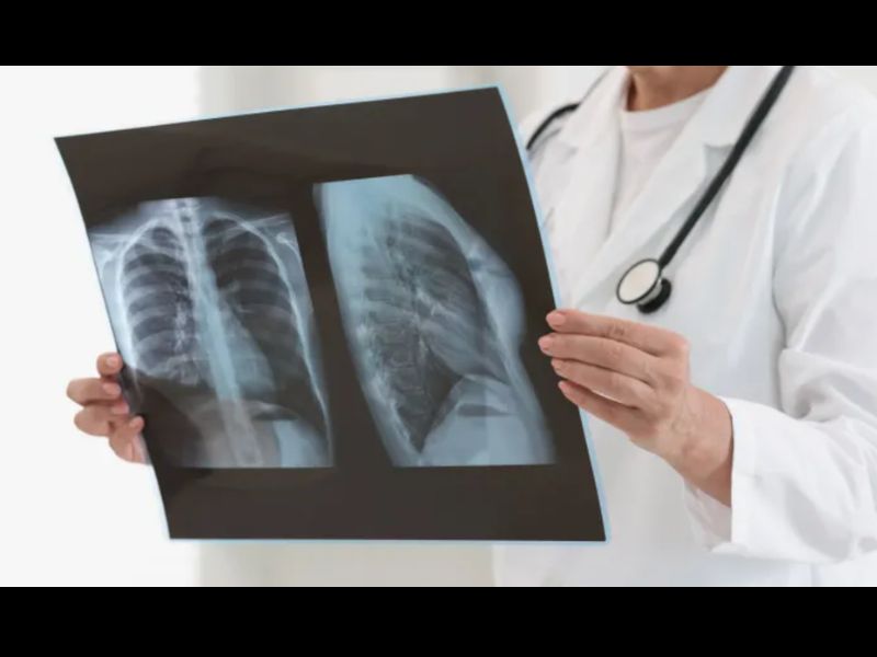 Diagnostiquer la pneumonie en un souffle : le capteur révolutionnaire du MIT