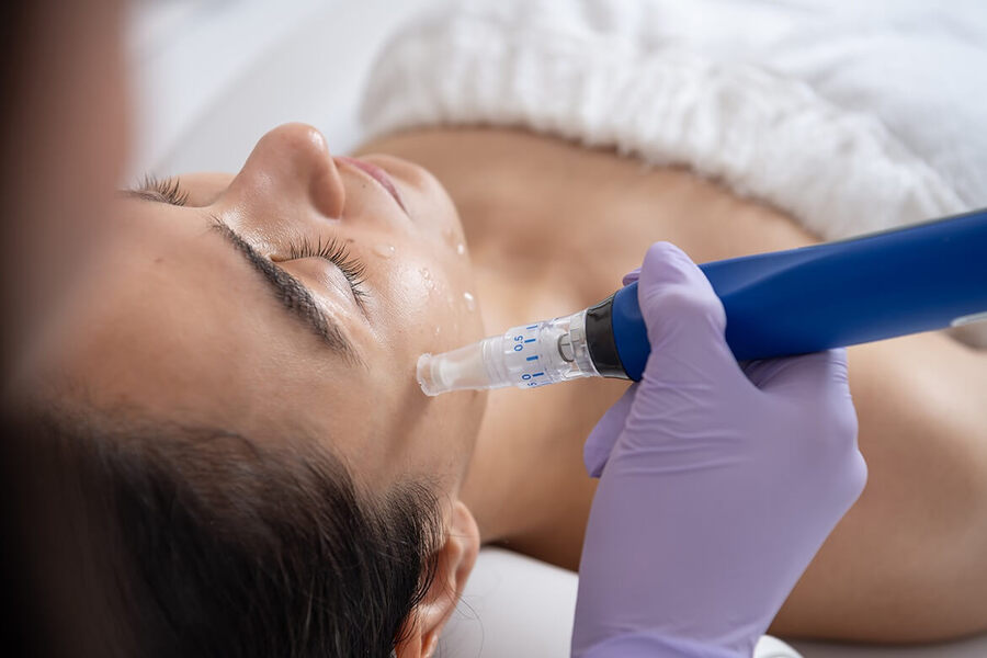 Microneedling : pourquoi l’hiver est-il la saison privilégiée pour prendre soin de sa peau ?