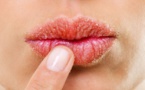 5 astuces pour soigner et embellir les lèvres gercées