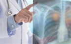Pollution : La compréhension du cancer du poumon fait une avancée majeure