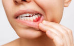 De la gingivite à la parodontite : Tout sur la maladie des gencives