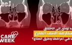 Care Week : قد تؤدي إلى الاختناق، متلازمة الأنف الفارغ، ما هي أعراضها وطرق العلاج؟