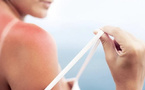 Burn lines : quand le bronzage devient un coup de soleil volontaire