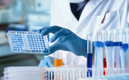 Une réforme majeure pour les laboratoires de santé