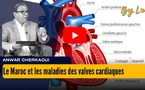 [vidéo] : Le Maroc peut-il renforcer sa riposte contre les maladies des valves cardiaques ?