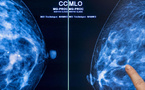 L’IA prédit le risque de cancer du sein plusieurs années à l’avance