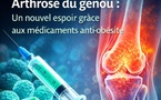 Arthrose du genou : les médicaments contre l’obésité ouvrent une piste thérapeutique inattendue