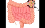 Le microbiome intestinal : une piste prometteuse pour la détection précoce de la maladie de Parkinson