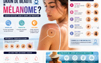 Comment distinguer un grain de beauté d’un mélanome ?