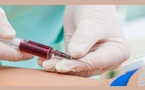 Analyses sanguines : ces habitudes quotidiennes peuvent fausser les résultats