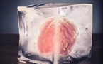 Une start‑up américaine affirme avoir réussi à préserver la structure du cerveau après la mort