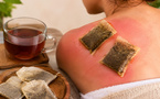 Coup de soleil : cette astuce au thé noir pourrait bien vous surprendre