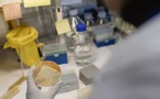 Microbiote : cette enzyme découverte par l’Institut Pasteur pourrait changer notre compréhension des microbes intestinaux