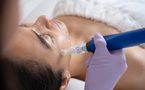 Microneedling : pourquoi l’hiver est-il la saison privilégiée pour prendre soin de sa peau ?