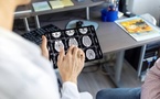 Cancer : près de 4 cas sur 10 pourraient être évités, les facteurs de risque passés au crible