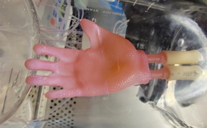 Grâce à l’impression 3D, des chercheurs créent des greffes de peau à « enfiler »