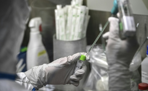 Pasteur abandonne son principal projet de vaccin anti-Covid19, pas assez efficace
