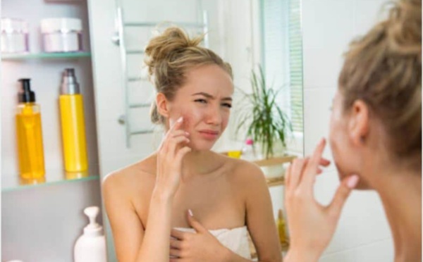 Découvrez la cause des boutons en fonction de leur localisation !