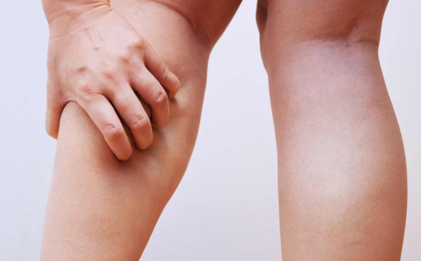 Jambes lourdes : quels nutriments privilégier ?