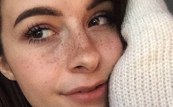 Comment avoir des tâches de rousseur avec du henné ?