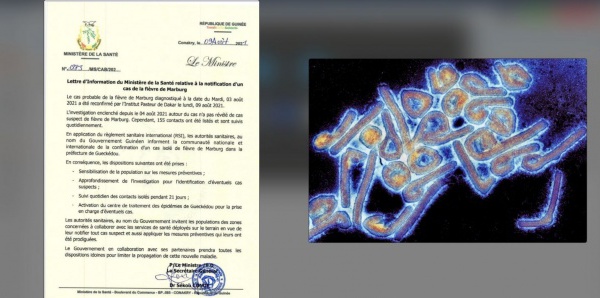 Virus Marburg : quelle est cette maladie qui vient d'être détectée  ?