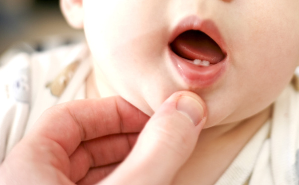 Les poussées dentaires chez les bébés : Souriez, rien de grave
