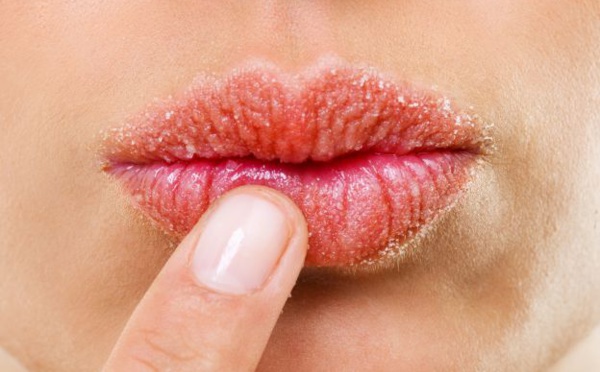 5 astuces pour soigner et embellir les lèvres gercées