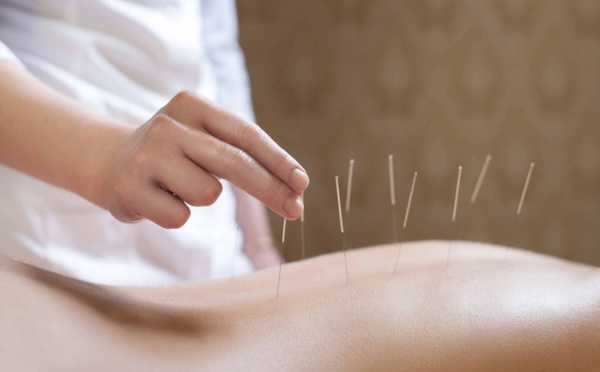  l’acupuncture est-elle efficace pour augmenter ses performances sportives ?
