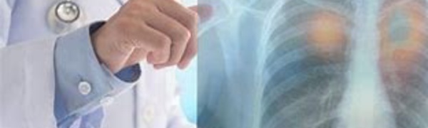 Pollution : La compréhension du cancer du poumon fait une avancée majeure