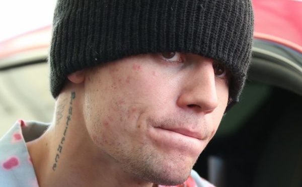 Justin Bieber reporte toutes les dates de la tournée "Justice" 