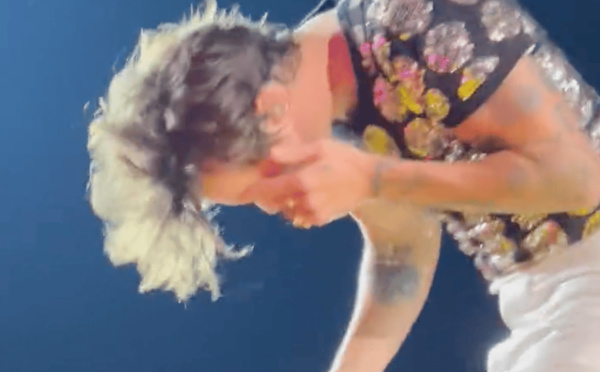 Harry Styles touché au visage par un projectile en plein concert