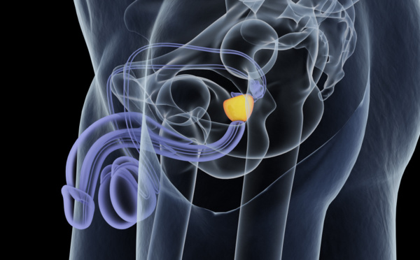 Problémes de prostate ! 10 questions à votre médecin