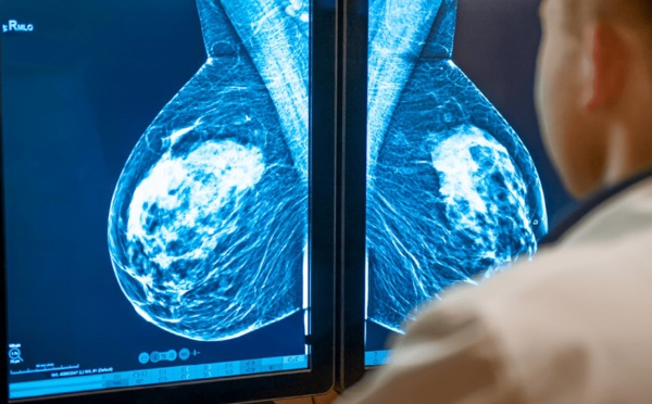 Cancer du sein : une intelligence artificielle pourra aider au diagnostic