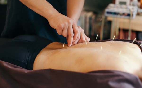 L’acupuncture pour améliorer la fertilité