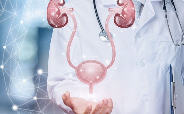 Destruction de la fonction rénale: Attention aux Calculs des voies urinaires