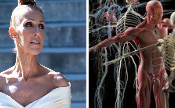 La maladie de Céline Dion 