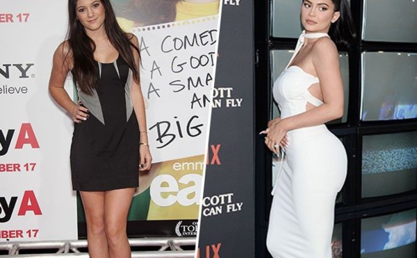 Kylie Jenner affirme avoir des regrets concernant la chirurgie esthétique