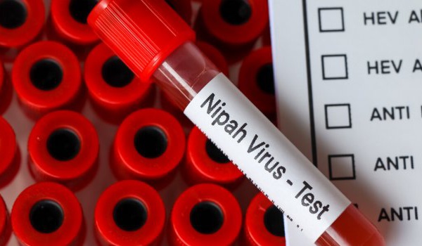 Nipah : virus qui sévit en Inde ?